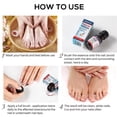 thumbnail image 2 of Eliminación de hongos en las uñas 10ml Gel de suero Anti infección Cuidado de las uñas Pies Reparación de uñas de los pies, 2 of 7