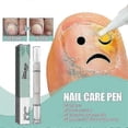 thumbnail image 2 of 3-9x Nail Care Pen, Nail Fungus Austrian Experiences, Nail Care Pen Experiences, Nail Fungus Treatment Quick Intensive, Nail Repair Remover, 2 of 5