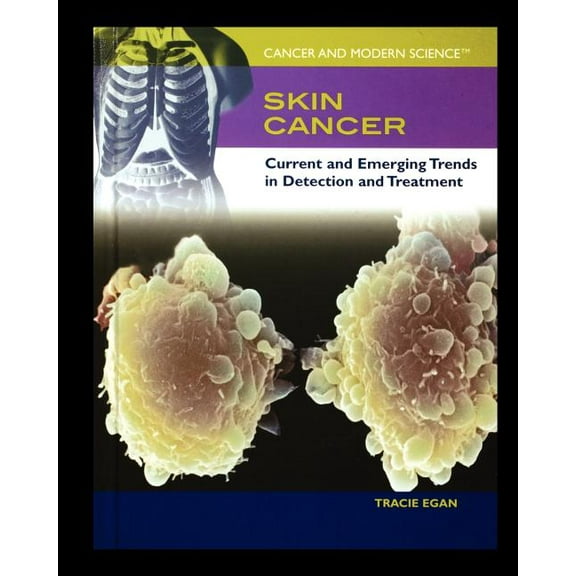 Cancer and Modern Science: Skin Cancer : Current and Emerging Trends in Detection and Treatment (Paperback)