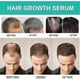 thumbnail image 4 of Jaysuing Dense Hair Essence Repair And Moisturize Dry Hair To Prevent Dense Hair, 4 of 5