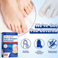 thumbnail image 3 of Nail Correction Stickers Ingrown Toenail Corrector Patches Treatment Recover Co, 3 of 5