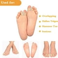 thumbnail image 6 of Toe Straightener-Soft Hammertoe Corrector, Double Orifice Design Big Toe Separator, Suitable for Overlapping(4pcs) - L, 6 of 7