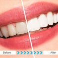 thumbnail image 4 of 25 replacement brush heads for Fairywill/Seago electric toothbrush, 4 of 4