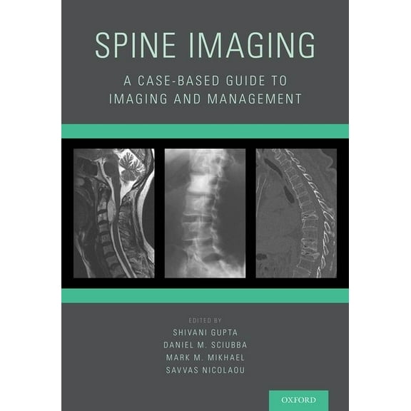 Spine Imaging: A Case-Based Guide to Imaging and Management, (Paperback)