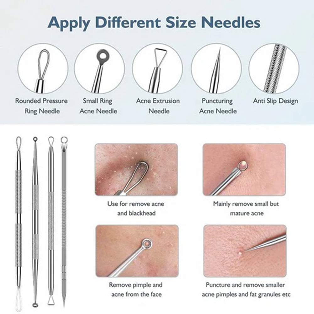 Blackhead Remover Tool Kit Popper Tool with Diagonal Tweezers