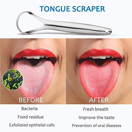 Cafhelp 2-Pack Tongue Scraper, 100% Useful Surgical Stainless Steel Tongue  Cleaner for Both Adults and Kids, Professional Reduce Bad Breath Metal