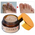 thumbnail image 1 of Crema Reparadora De Pies Crema De Tratamiento Para Pelar Los Pies Extracto De Hierbas Ungüento Anti-pulgadas Peeling De Pies Crema De Tratamiento De Eccema Beriberi Cuidado De Los YLSHRF Anti Inching Cream, 1 of 8