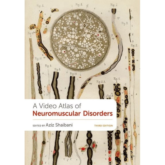 A Video Atlas of Neuromuscular Disorders, (Paperback)