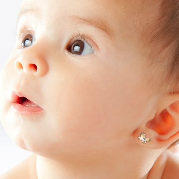 Nacido Bebes Nacen Amarillos Bilirrubina Ojos Amarillos En Bebes