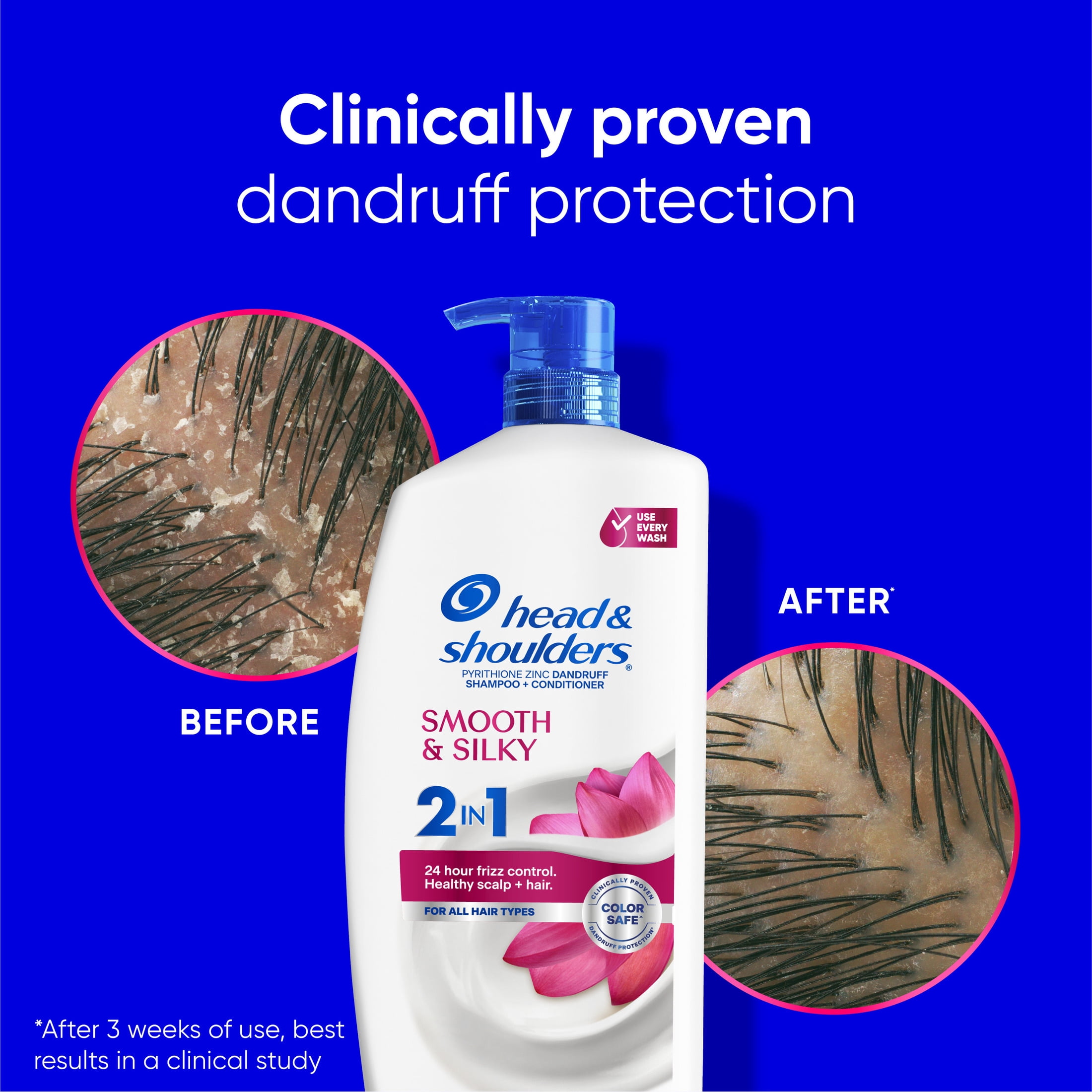4 pack) Head & Shoulders Anti-Dandruff 2in1 Shampoo and