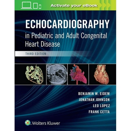 UPC: 9781496394019 | Echocardiography in Pediatric and Adult Congenital Heart Disease (Edition 3) (Hardcover)