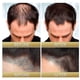 thumbnail image 5 of Black Rice Hair Spray Moisturizing Repair Solid Hair Dense Hair Repair Supple Universal Hair Growth Spray, 5 of 5