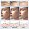 thumbnail image 2 of Parche para heridas por quemadura Accesorios de piel multifuncionales portátiles de silicona ligera Ygjytge Cuidado Belleza, 2 of 6