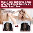 thumbnail image 2 of 3pcs Women Bangs 5% Foam For Thinning Hair And Hair Loss, Hair Regrowth Treatment, 2 of 5