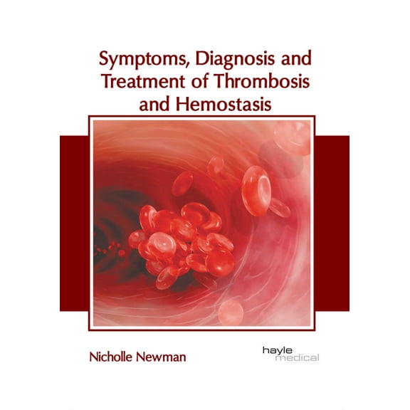 Symptoms, Diagnosis and Treatment of Thrombosis and Hemostasis, (Hardcover)