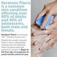 thumbnail image 4 of Body Soap for Keratosis Pilaris | Exfoliating Soap Scrub with 10% AHA & Micro Pumice Beads | Buffingbar for Smooth Skin, Strawberry Legs, Ingrown Hair & Razor Bumps, 4 of 7