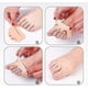 thumbnail image 2 of 10 Pairs Metatarsal Pads, Gel Foot Pads Forefoot Cushions Bone Pad Breathable, 2 of 5