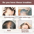 thumbnail image 5 of Productos para el cuidado del cabello Champú para cabello negro y grueso, Champú anticanas, Champú jabón, Champú en barra para ennegrecer el cabello, Promueve el crecimiento del cabello y previene la, 5 of 5