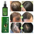 thumbnail image 2 of Suero de extracto de jengibre, productos en aerosol anticaída, tratamiento del adelgazamiento del cabello, reparación rápida y seca, previene, 2 of 5