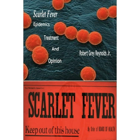 Scarlet Fever Epidemics Treatment And Opinion -