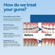 thumbnail image 4 of Gum Therapy Gel, Deep Cleaning Tooth Stains, Tartar, Sore Gums, Gum Care Dental Cleansing Gel, 4 of 5