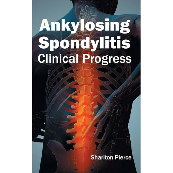 Ankylosing Spondylitis: Clinical Progress, (Hardcover)