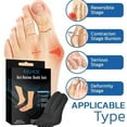 thumbnail image 3 of Anti Bunions Health Socks, Bunions Relief Socks, Orthopedic Compressing Sock, Women Toe Socks Breathable Five Finger Split Toe Socks, 3 of 7