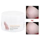 thumbnail image 3 of Crema Para Estrías, Tratamiento Ligero Para Estrías Conveniente Para Reparar Y Calmar La Piel ANGGREK Otros, 3 of 8