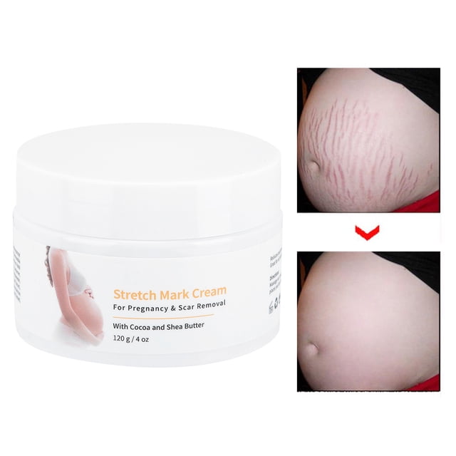 Crema para estrías de 120g crema para eliminar cicatrices y estrías loción para embarazo crema para estrías crema para prevención de estrías de maternidad ANGGREK Otros