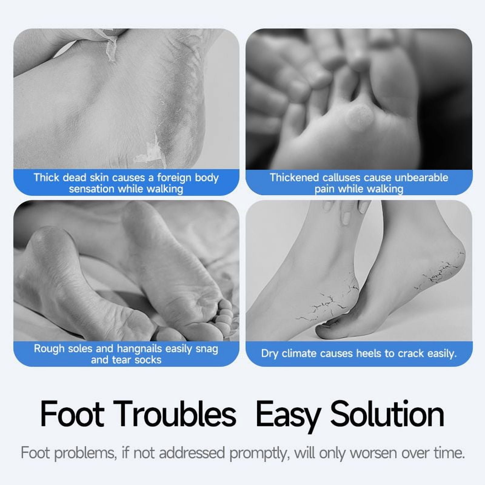 Wireless Electric Foot Callus Remover, 3-Speed Adjustable Foot File with Stainless Steel Heads, Portable & Rechargeable Foot Grinder for Dead Skin Removal, IPX6 Waterproof, Includes 2 Grinding Heads