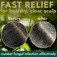 thumbnail image 4 of Tea Tree Scalp Scrub | Itchy & Dry Scalp Care with Tea Tree Oil, Quartz Powder & Sea Salt | Gently Exfoliates, Helps Reduce Flakes, Supports Healthy Hair Growth & Scalp Balance, 4 of 6