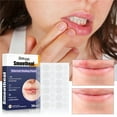 thumbnail image 1 of Parche Curativo Discreto Xihbxyly Para Herpes Labial, 1 of 7