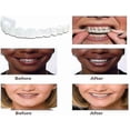thumbnail image 4 of 2-pack Snap-on Dentures Denture Veneers Denture Denture, 4 of 5