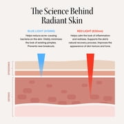 Solawave Bye Acne Spot Treatment - Red & Blue Light Therapy Device for Face & Body - Reduces Redness & Inflammation