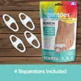 thumbnail image 6 of ZenToes Toe Separators with 2 Loops – pack of 4 Soft Gel Bunion Correctors (White), 6 of 7