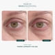 thumbnail image 3 of Gel para Ojos Marini SkinSolutions Luminate con Retinol 15 mL, 3 of 6