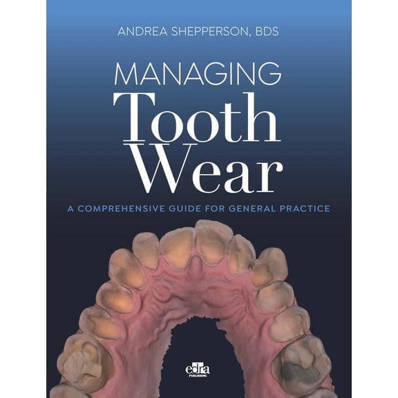 Managing Tooth Wear (C) / Shepperson, (Hardcover)