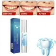 thumbnail image 1 of Teeth Whitening Essence, Teeth Whitening Essence Pen, Teeth Stain Remover to Whiten Teeth, Teeth Whitening Gel, Fast and Effective Removal Tooth Stain Removal, 1 of 6