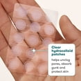 thumbnail image 5 of (2 pack) Proactiv Zits Happen® Hydrocolloid Acne Patches, Pimple Patches for Acne with Pore Cleansing Salicylic Acid, 30 Count, 5 of 8