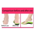 thumbnail image 3 of Kids Orthotic Arch Support Insoles Plantar Fasciitis Cushioning Shoe Inserts Shock Absorption Velvet Surfaces Deep Heel Cup Chinldren Inner Soles for Flat Feet 1 Pair Green L, 3 of 7