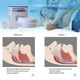 thumbnail image 3 of 2PCS ANTI SNORING MOUTH GUARD, Device Sleep Aide Adjustable Mouth-Free Buds, 3 of 5