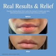 thumbnail image 4 of Bálsamo en barra Healing Balm Stick Flanders 15 g sin fragancia para piel sensible, 4 of 8