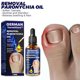 thumbnail image 4 of German Toenailcare Oil For Removing Paronychia, Ingrowing Toenail Treatment Oil‖ E4Q0, 4 of 7