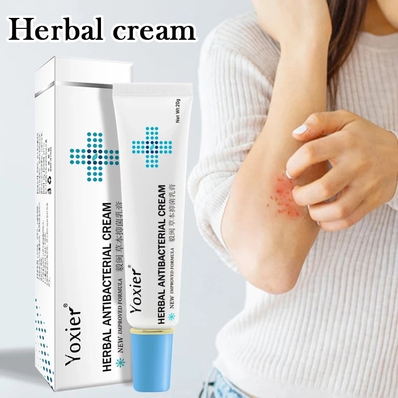 20G Skin Rash Cream Eczema Ointment Anti-Fungal Cream Psoriasis Treatment