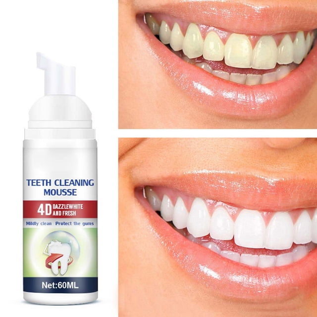 Teeth Cleaning Tooth Stain Removal and Cleaning Toothpaste Teeth Oral Cleaning and Fresh Breath Foam Paste