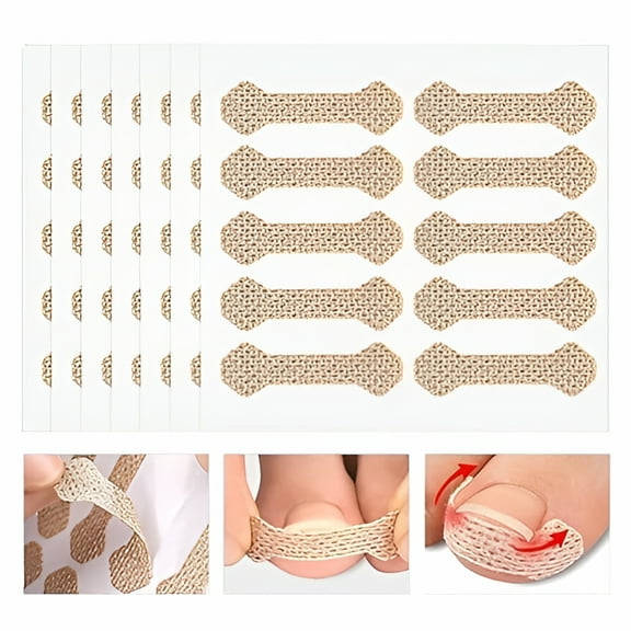 QARUN 100-Piece Ingrown Toenail Treatment & Painless Nail Repair Kit with Ingrown Toenail Strips & Pedicure Tool