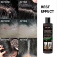thumbnail image 3 of Champú de jengibre anti-descamación 3x para la fijación del cabello, reparación, sequedad, daño, antipicazón, control de grasa, cabello esponjoso, sin rocío, 3 of 5