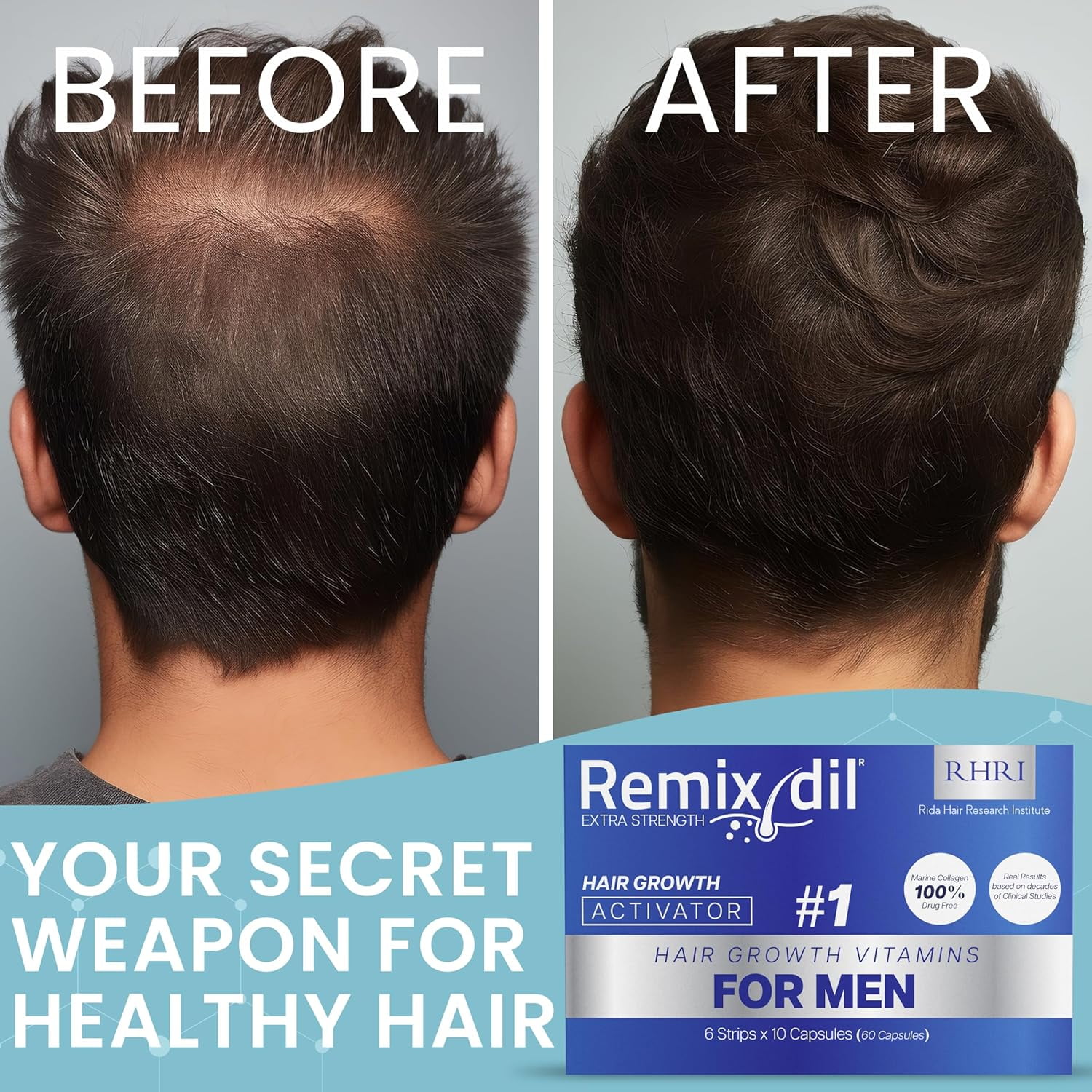 Hair Growth Vitamins Hair Regrowth For Men  Supports Beard And Scalp Strength  Helps Reduce Thinning And Breakage