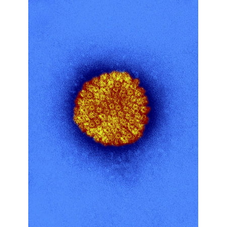 Herpes Simplex Virus Belongs to a Group of Deoxyriboviruses Print Wall Art By Harold