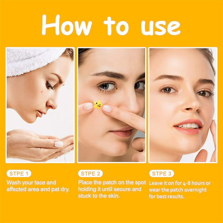 NOGIS Star Acne patch For Face,Cute Hydrocolloid Acne Patch NOGIS Star Acne patch For Face,Cute Hydrocolloid Acne Patch